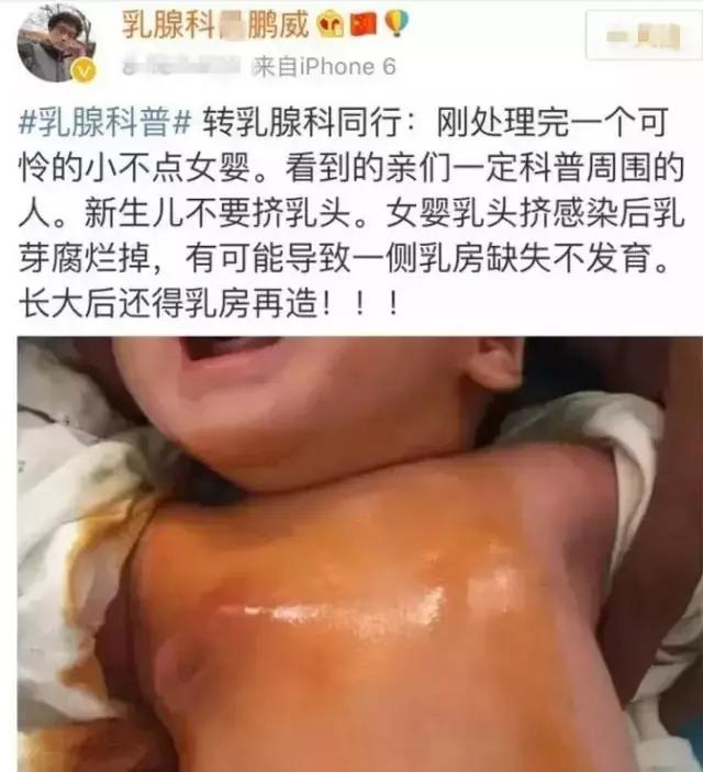 容易让新生儿受伤的生理现象，辨别和正确处理